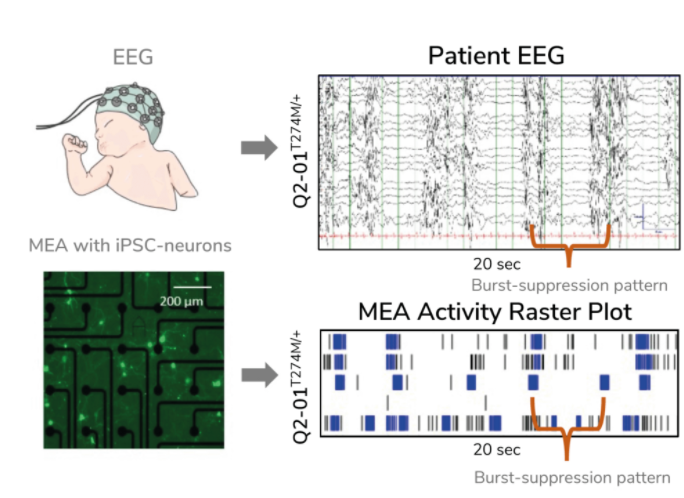 Epilepsy recordings and recordings from neurons