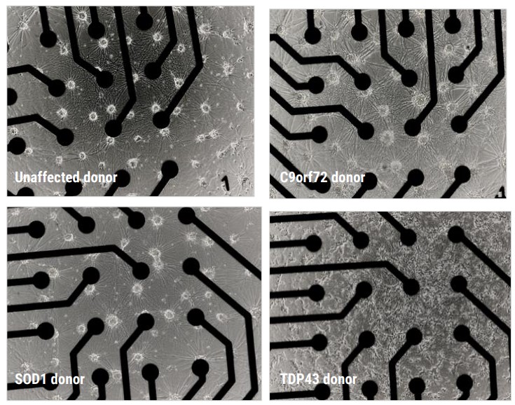 Figure 2B