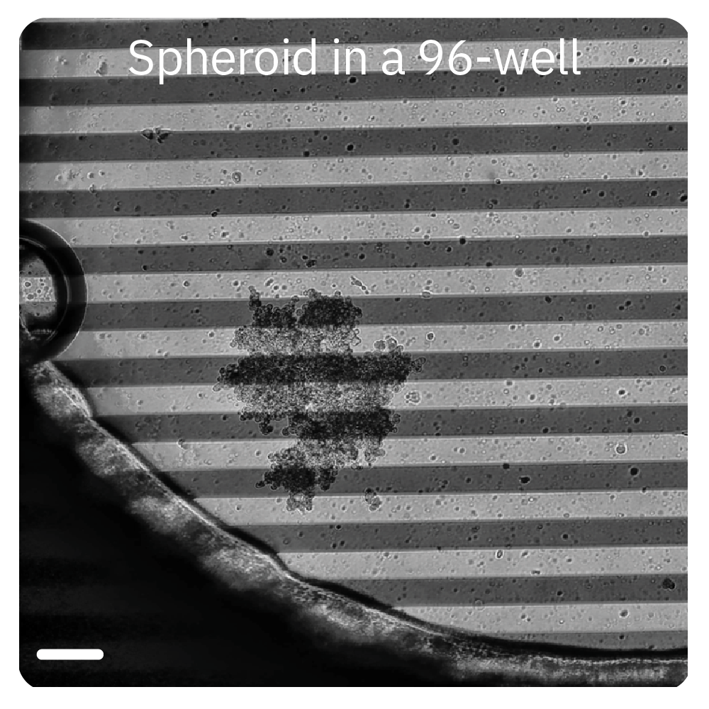 Spheroid in a 96-well