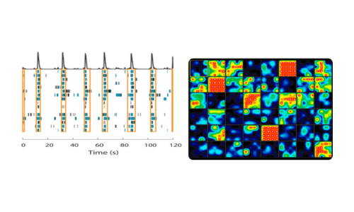 Neural Activity