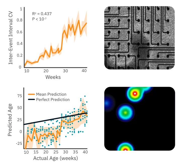 Dive into organoids to model brain development