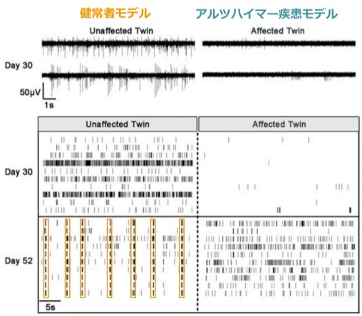 Unaffected Twin vs. Affected Twin graphs