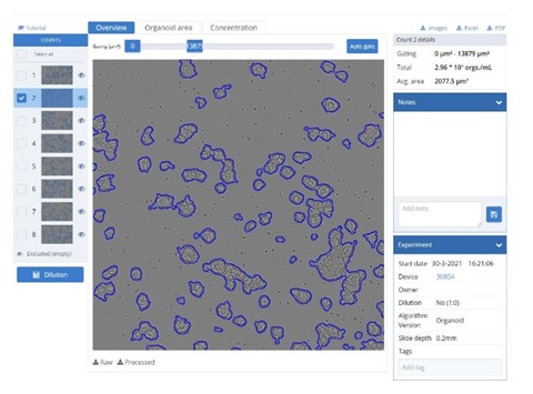 Counting Organoids