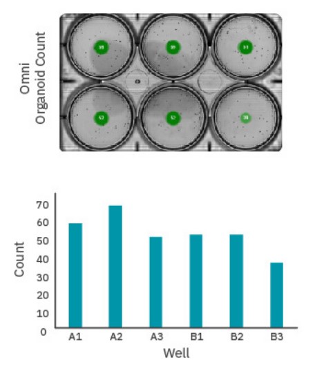 The Omni’s whole-vessel scans ensure each EB is always counted 