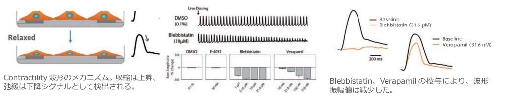 Contractility