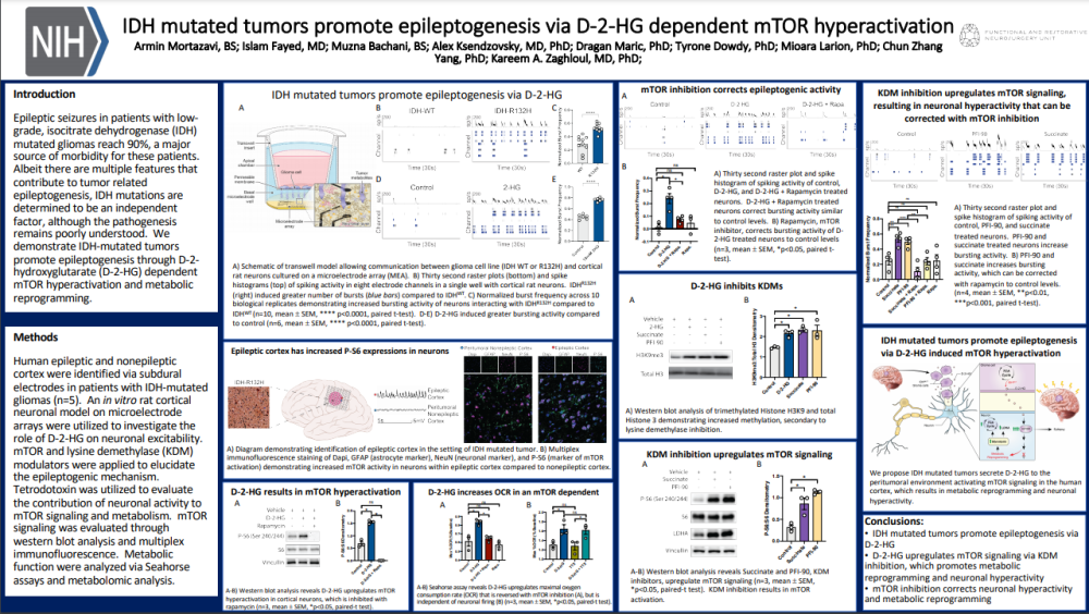 sfN 2021 Poster on brain turmors and epilepsy mechanism recorded on multiwell MEA system